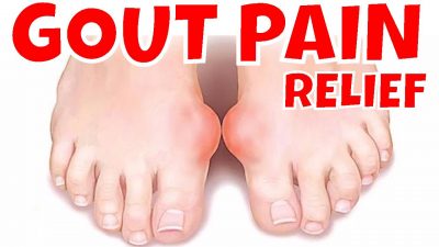 homeopathy for gout